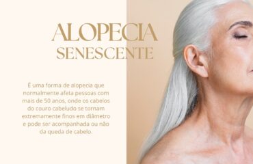 alopecia senescente